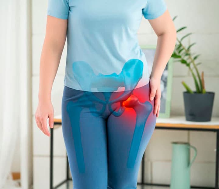 Tratar pinzamiento y lesiones de labrum en Pontevedra