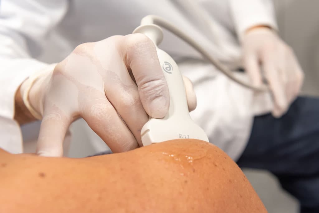 Lesiones del manguito rotador en Pontevedra