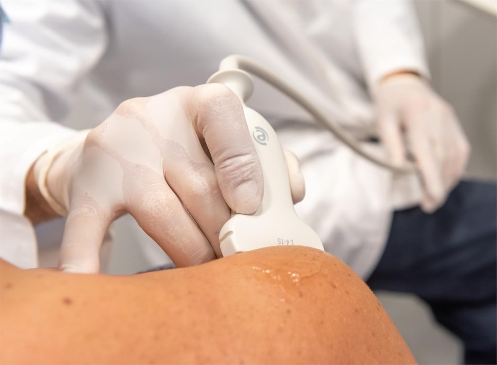 Luxación de hombro: qué hacer en el momento y cómo es la recuperación