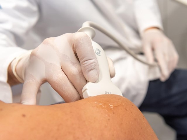 Luxación de hombro: qué hacer en el momento y cómo es la recuperación