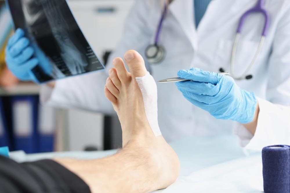 ¿Qué es la cirugía percutánea del pie y qué ventajas tiene?