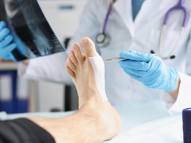 ¿Qué es la cirugía percutánea del pie y qué ventajas tiene?